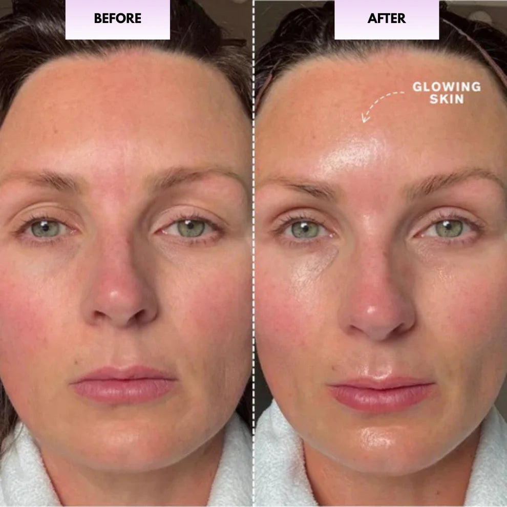 Velina™ Glow Sculpt - Beauty Roller