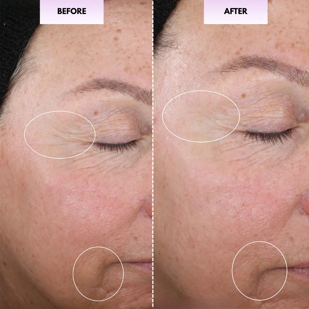 Velina™ Glow Sculpt - Beauty Roller